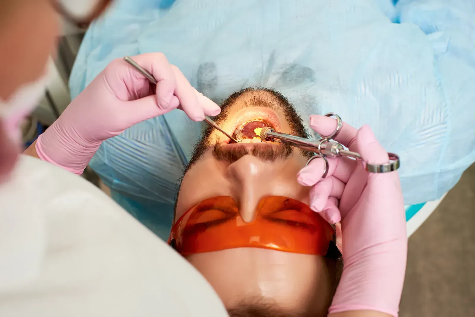 Tooth Extractions