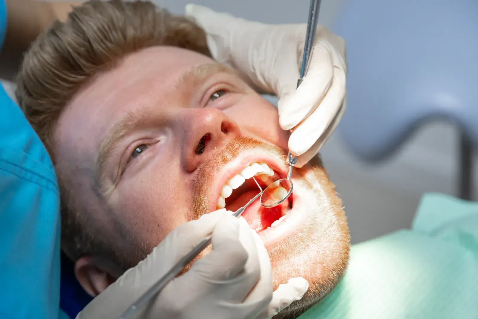 Wisdom Teeth Removal